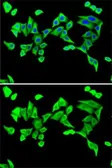 Anti-Parathyroid Hormone antibody used in Immunocytochemistry/ Immunofluorescence (ICC/IF). GTX32772