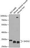 Anti-SHOX2 antibody used in Western Blot (WB). GTX32873