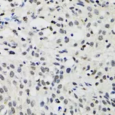 Anti-SMARCAD1 antibody used in IHC (Paraffin sections) (IHC-P). GTX32882