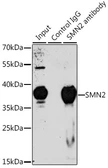 Anti-SMN2 antibody used in Immunoprecipitation (IP). GTX32884