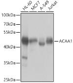 Anti-ACAA1 antibody used in Western Blot (WB). GTX32986