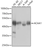 Anti-ACAA1 antibody used in Western Blot (WB). GTX32986