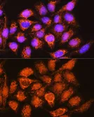Anti-ALDH1B1 antibody used in Immunocytochemistry/ Immunofluorescence (ICC/IF). GTX32998