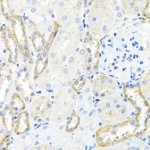 Anti-BSND antibody used in IHC (Paraffin sections) (IHC-P). GTX33045