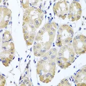 Anti-CBR4 antibody used in IHC (Paraffin sections) (IHC-P). GTX33068