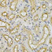 Anti-FHL1 antibody used in IHC (Paraffin sections) (IHC-P). GTX33199