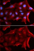 Anti-NQO2 antibody used in Immunocytochemistry/ Immunofluorescence (ICC/IF). GTX33363