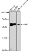 Anti-P4HA2 antibody used in Western Blot (WB). GTX33379