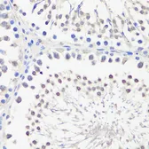 Anti-PBK antibody used in IHC (Paraffin sections) (IHC-P). GTX33388