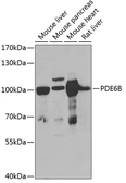 Anti-PDE6B antibody used in Western Blot (WB). GTX33395
