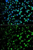 Anti-Thymidine Phosphorylase antibody used in Immunocytochemistry/ Immunofluorescence (ICC/IF). GTX33396