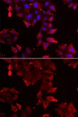 Anti-PDLIM1 antibody used in Immunocytochemistry/ Immunofluorescence (ICC/IF). GTX33399