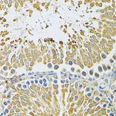 Anti-PIBF1 antibody used in IHC (Paraffin sections) (IHC-P). GTX33409