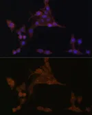 Anti-PPAT antibody used in Immunocytochemistry/ Immunofluorescence (ICC/IF). GTX33422