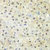 Anti-PSMD13 antibody used in IHC (Paraffin sections) (IHC-P). GTX33438