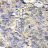 Anti-SDHA antibody used in IHC (Paraffin sections) (IHC-P). GTX33490
