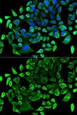 Anti-TAB1 antibody used in Immunocytochemistry/ Immunofluorescence (ICC/IF). GTX33533