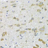 Anti-TCP1 delta antibody used in IHC (Paraffin sections) (IHC-P). GTX33536