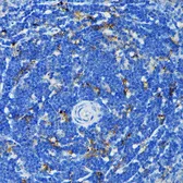 Anti-TNF Receptor I antibody used in IHC (Paraffin sections) (IHC-P). GTX33550