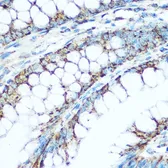 Anti-UQCRC1 antibody used in IHC (Paraffin sections) (IHC-P). GTX33572