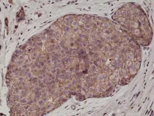 Anti-E-Cadherin antibody [RM244] used in IHC (Paraffin sections) (IHC-P). GTX33614