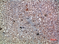 Anti-IL20 antibody used in IHC (Paraffin sections) (IHC-P). GTX34012