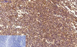 Anti-Survivin antibody [Mix] used in IHC (Paraffin sections) (IHC-P). GTX34059