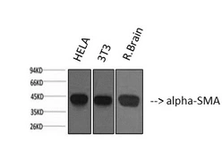 Anti-alpha Smooth Muscle Actin antibody [6A12] used in Western Blot (WB). GTX34111