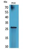 Anti-POLR3G antibody used in Western Blot (WB). GTX34131