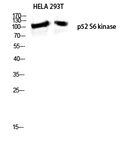 Anti-RPS6KC1 antibody used in Western Blot (WB). GTX34179