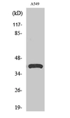 Anti-Surfactant Protein B antibody used in Western Blot (WB). GTX34194