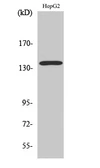 Anti-SNIP / p140Cap antibody used in Western Blot (WB). GTX34226