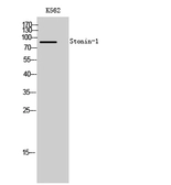 Anti-STON1 antibody used in Western Blot (WB). GTX34236