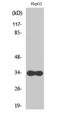 Anti-CYB5R3 antibody used in Western Blot (WB). GTX34344