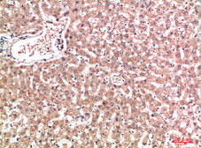 Anti-EPG5 antibody used in IHC (Paraffin sections) (IHC-P). GTX34368