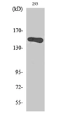 Anti-GAK antibody used in Western Blot (WB). GTX34383