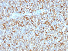 Anti-alpha 1 Antitrypsin antibody [AAT/1379] used in IHC (Paraffin sections) (IHC-P). GTX34404
