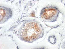 Anti-CD147 antibody [BSG/963] used in IHC (Paraffin sections) (IHC-P). GTX34463