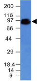 Anti-CD44 antibody [HCAM/918] used in Western Blot (WB). GTX34516