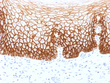 Anti-CD44v9 antibody [CD44v9/1459] used in IHC (Paraffin sections) (IHC-P). GTX34523