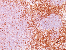 Anti-CD6 antibody [3F7B5] used in IHC (Paraffin sections) (IHC-P). GTX34535