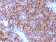 Anti-Chromogranin A antibody [CHGA/798] used in IHC (Paraffin sections) (IHC-P). GTX34599