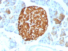 Anti-Chromogranin A antibody [LK2H10] used in IHC (Paraffin sections) (IHC-P). GTX34604