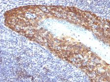 Anti-Cytokeratin 14 antibody [KRT14/532] used in IHC (Paraffin sections) (IHC-P). GTX34630