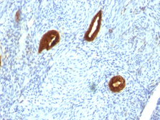 Anti-Cytokeratin 19 antibody [SPM266] used in IHC (Paraffin sections) (IHC-P). GTX34648