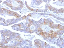 Anti-E-Cadherin antibody [SPM381] used in IHC (Paraffin sections) (IHC-P). GTX34681
