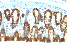 Anti-EpCAM antibody [EGP40/1110] used in IHC (Paraffin sections) (IHC-P). GTX34691