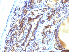 Anti-MAP3K1 antibody [2F6] used in IHC (Paraffin sections) (IHC-P). GTX34816