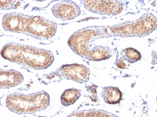 Anti-Melanoma gp100 antibody [PMEL/783] used in IHC (Paraffin sections) (IHC-P). GTX34837