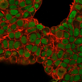 Anti-Nucleolin antibody [SPM614] used in Immunocytochemistry/ Immunofluorescence (ICC/IF). GTX34915
